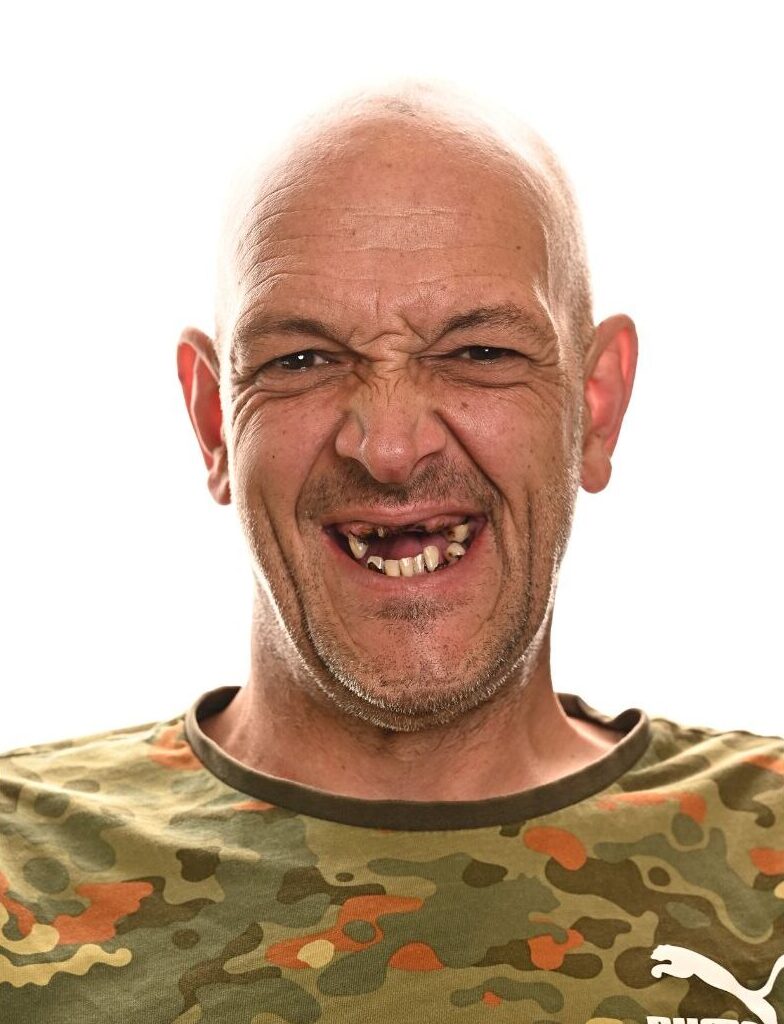 A middle-aged man with a bald head and missing teeth smiles in front of a white background. He is wearing a camouflage-patterned shirt.