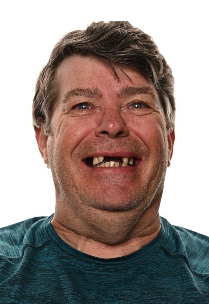 A middle-aged man with messy brown hair and missing front teeth smiles widely, wearing a teal shirt against a white background.