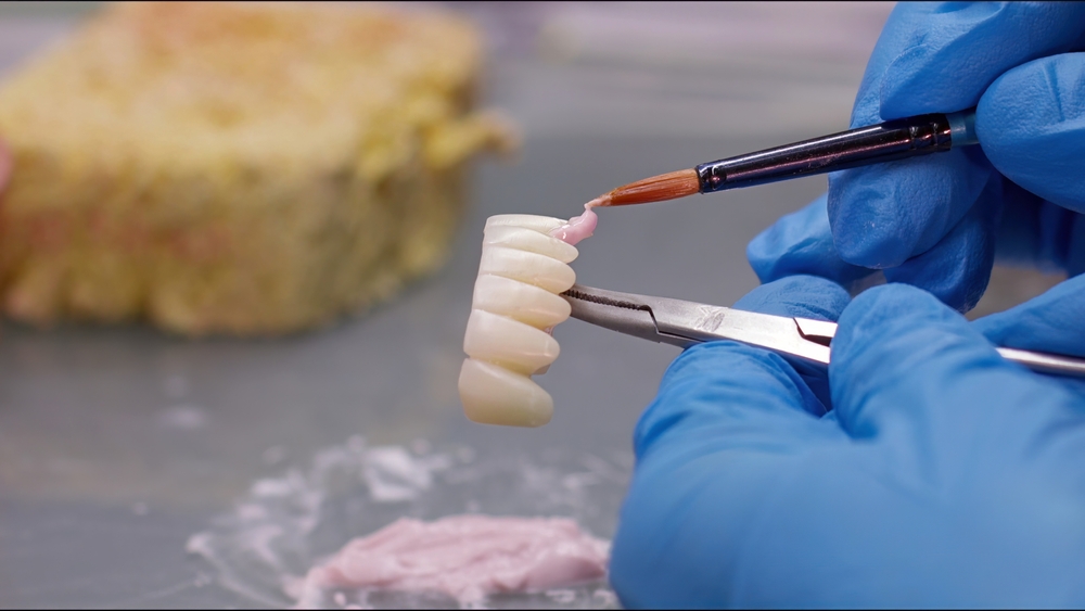 full mouth porcelain teeth red deer