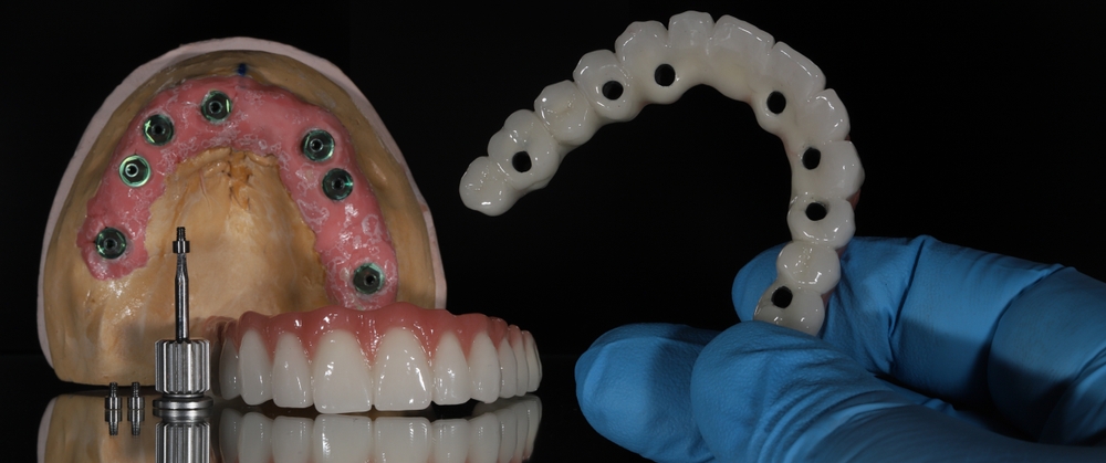 multi tooth implants the best solution for replacing multiple missing teeth