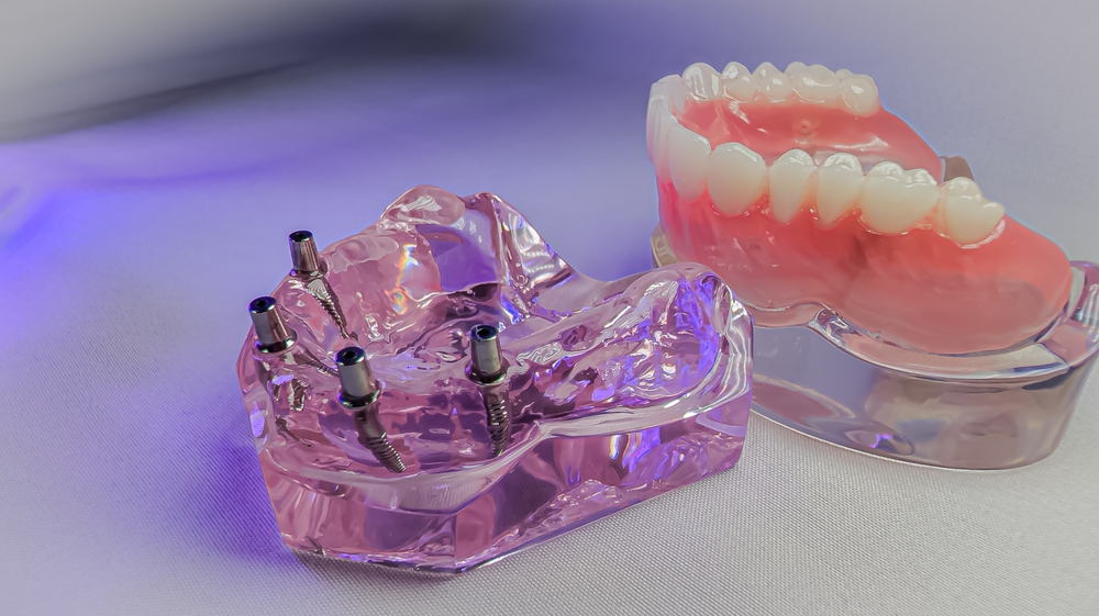 tired of slipping dentures try implant supported dentures