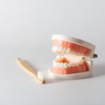 full-mouth porcelain teeth how they're attached and why they feel like real teeth