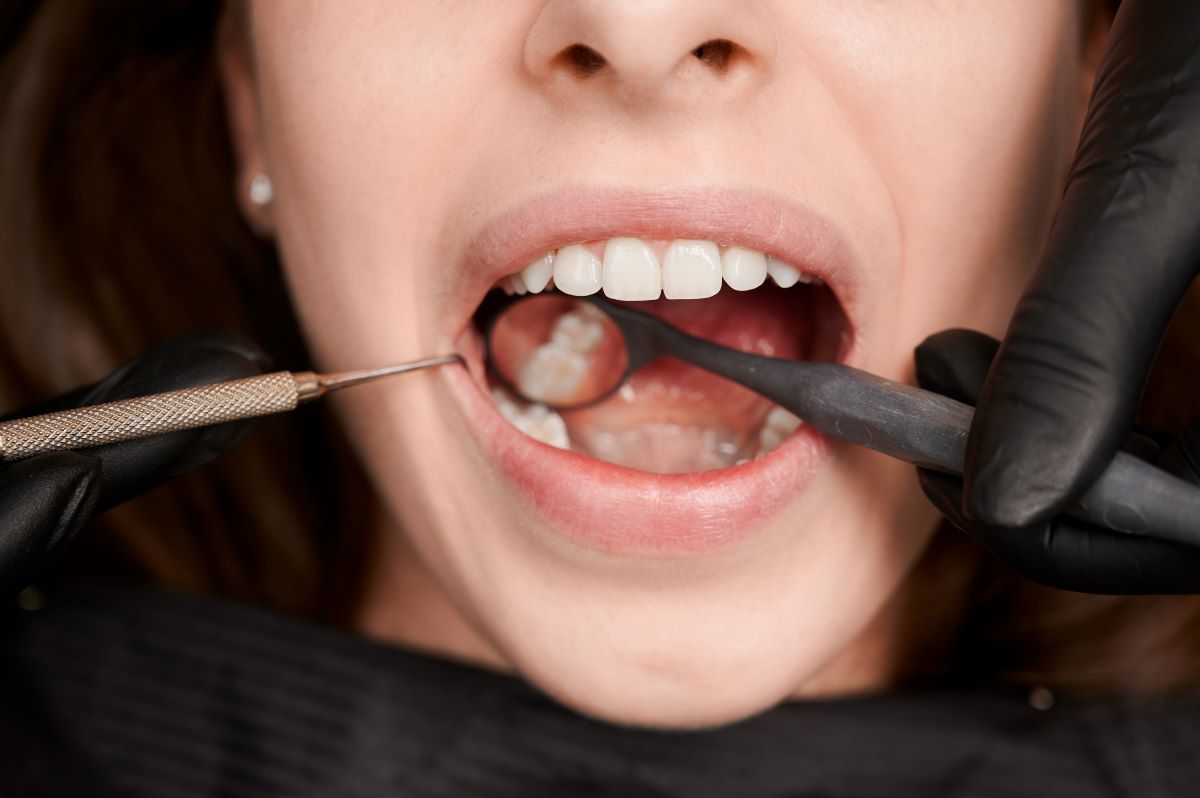 how much bone density do you need for dental implants
